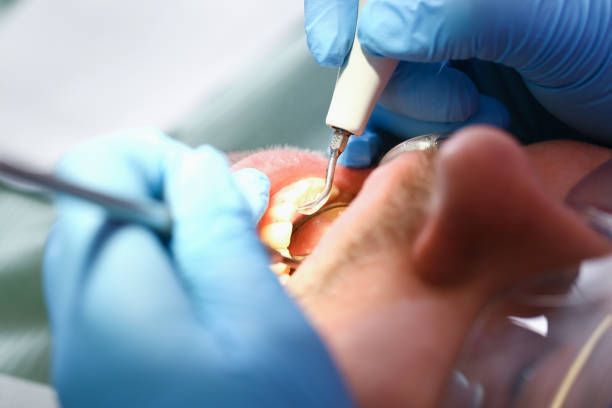 Best Tooth Infection Emergency Dentist  in Plymouth, OH