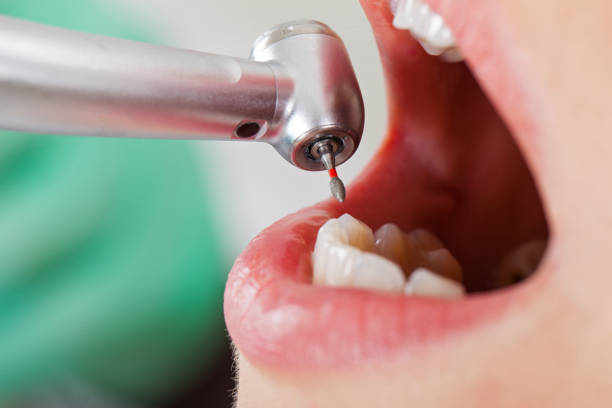 Emergency Gum Pain Relief in OH